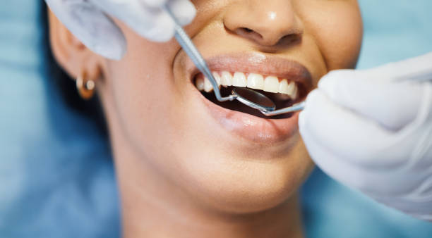Best Emergency Denture Repair in Louisville, NE